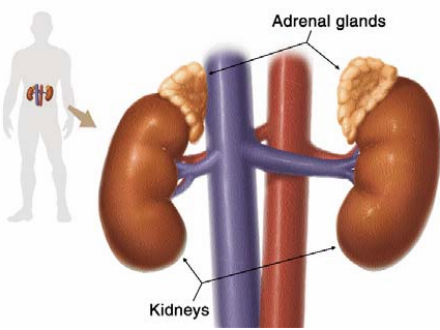 Ảnh 4 của Congenital adrenal hyperplasia